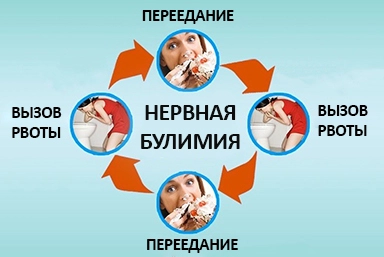 Лечение булимии в Сызрани